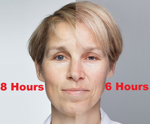 Sleep study volunteer, Sarah Chalmers, shown with 8 hours or sleep versus only 6 hours of sleep for a week.